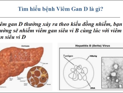 VIÊM GAN D
